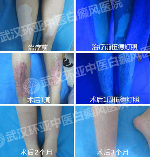 recell����1_����